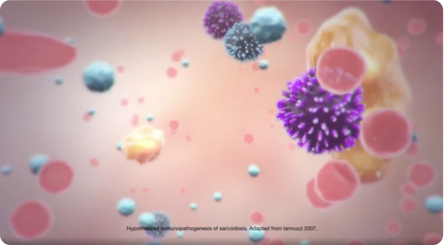 How Acthar Gel May Work video